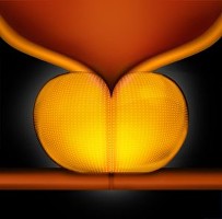 UroLift Treatment