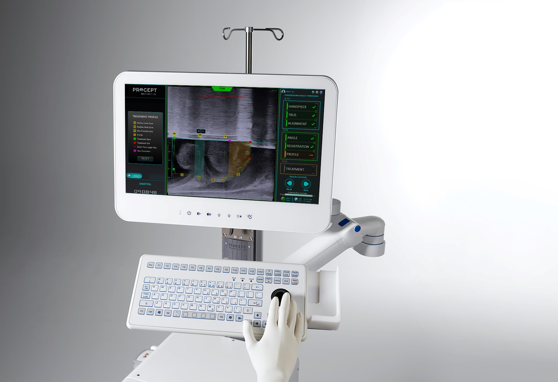 Aquablation therapy screen 
